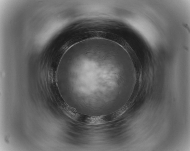 X0000091540093200708171254