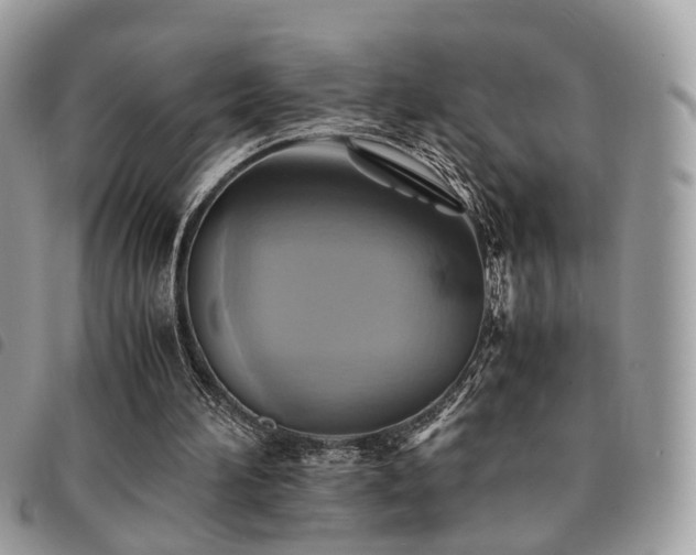 X0000091540196200708171252