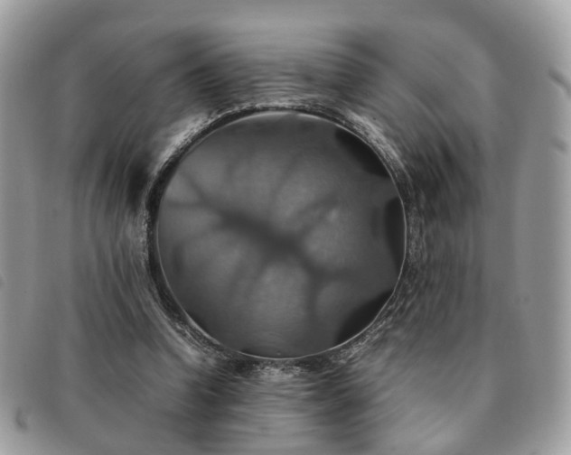X0000091540346200708171249