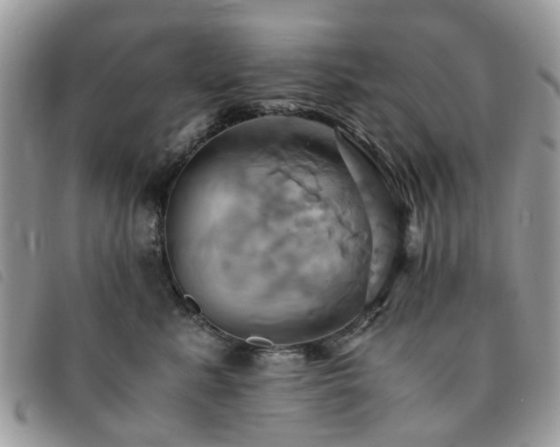 X0000091540619200708171245