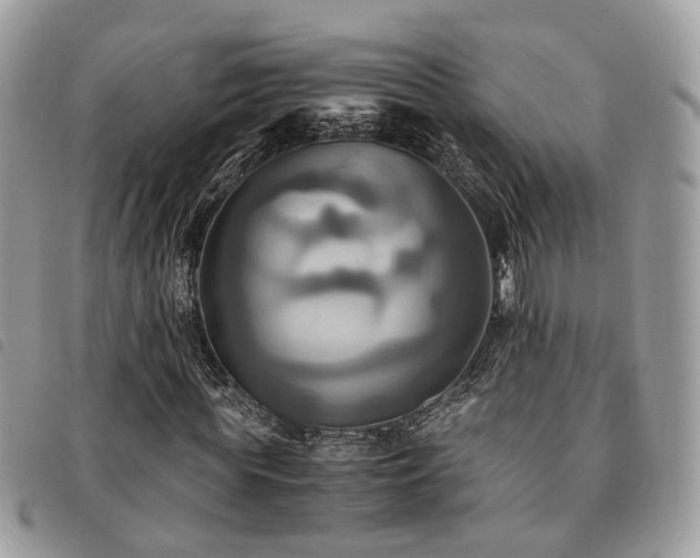 X0000091540819200708171242