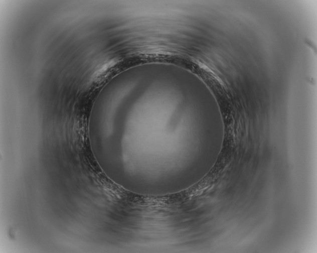X0000091540870200708171242