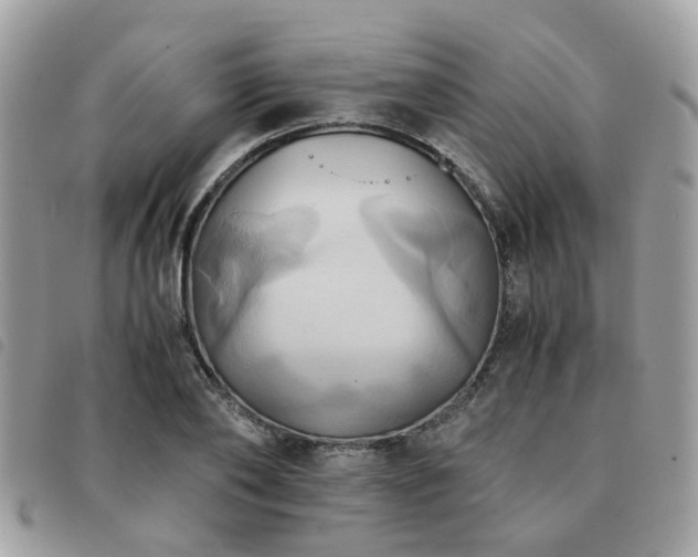 X0000091540886200708171241