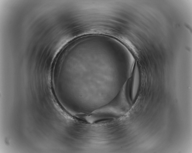 X0000091540896200708171241
