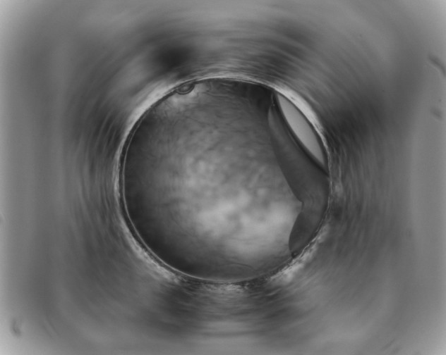 X0000091540957200708171241