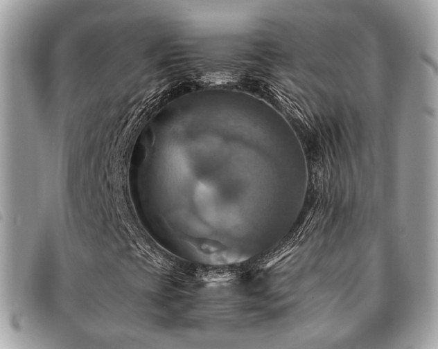 X0000091541393200708171233
