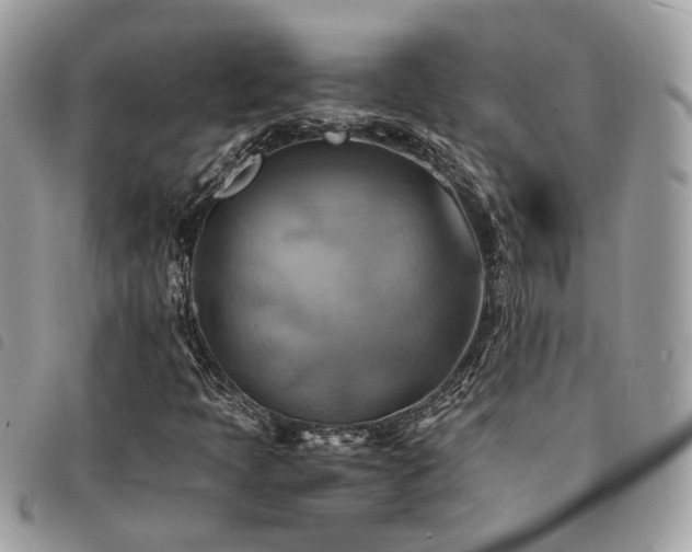 X0000091541397200708171233