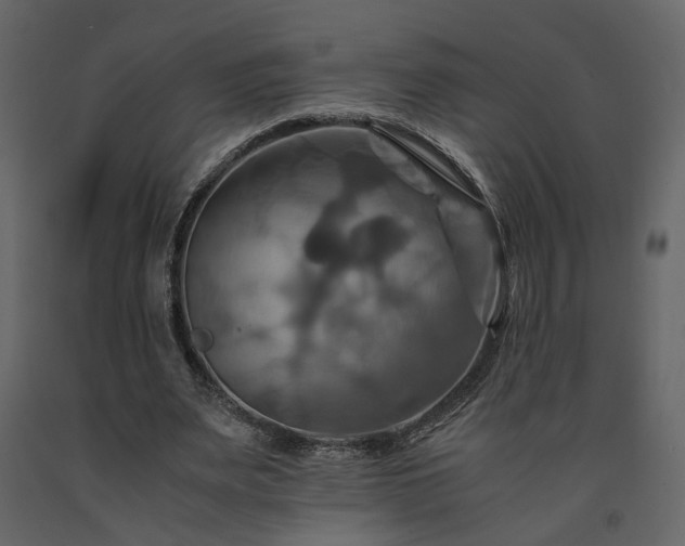 X0000091540487200708241737