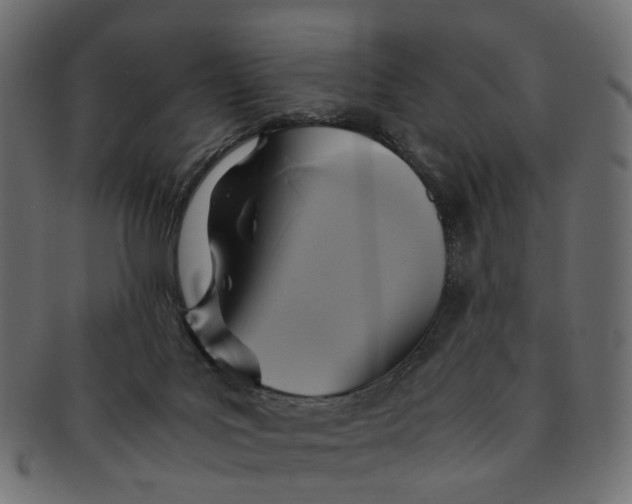 X0000091540027200709071114