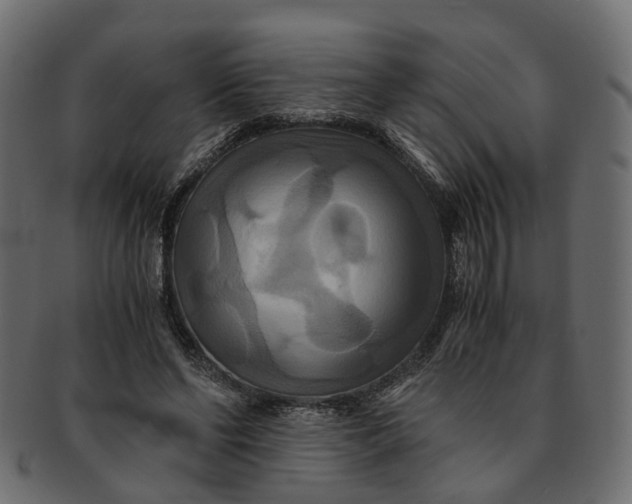 X0000091540494200709071107