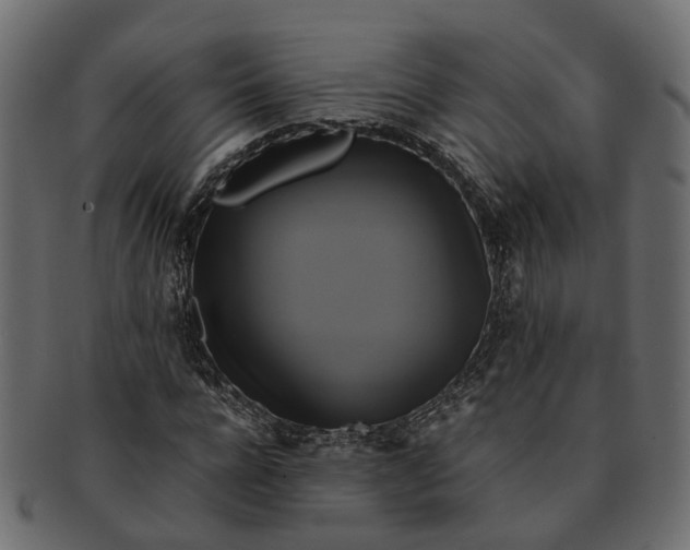 X0000091540920200709071101