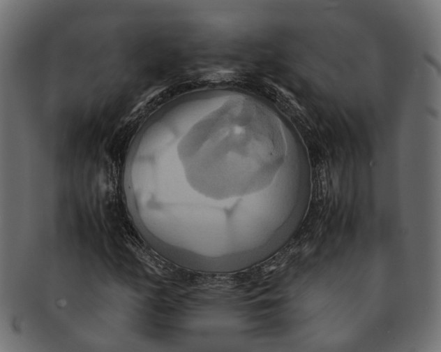 X0000091541158200709071057