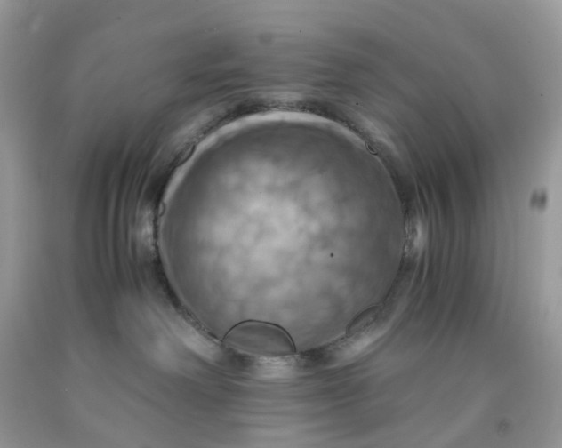 X0000091540238200709141502