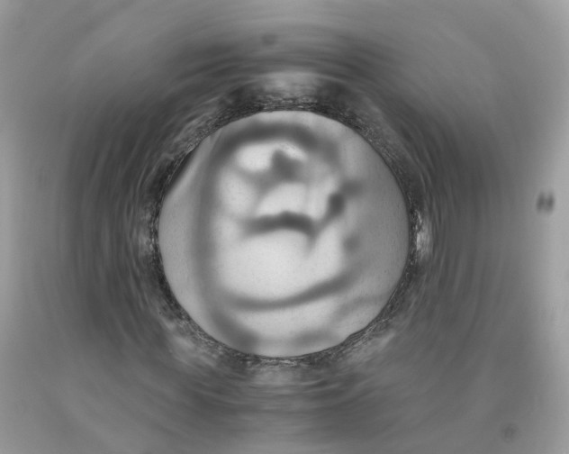 X0000091540819200709141454