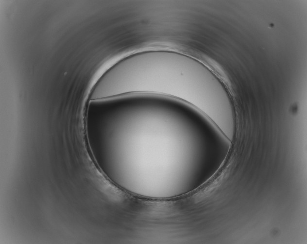 X0000091551192200708171035