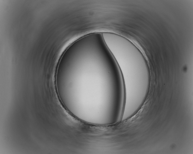 X0000091551197200708171035