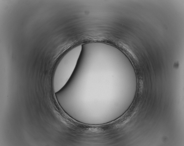 X0000091560541200708171103