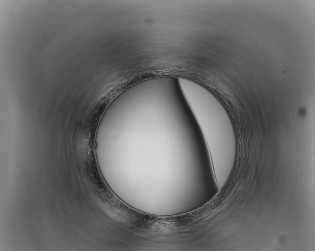 X0000091560599200708171103