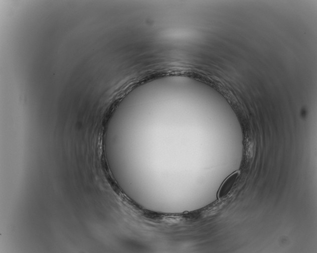 X0000091560666200708171102