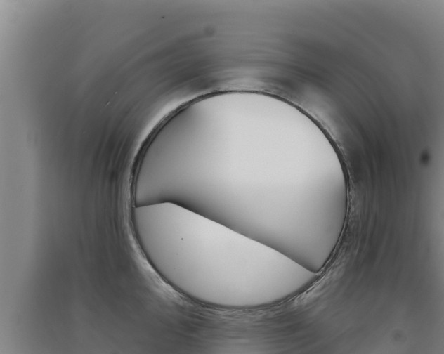 X0000091561000200708171057