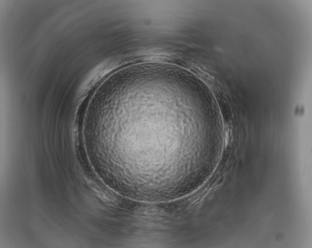 X0000091560339200708171330