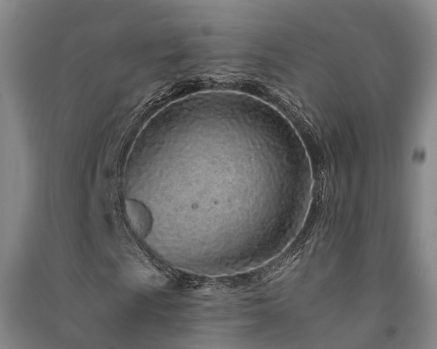 X0000091561009200708171321