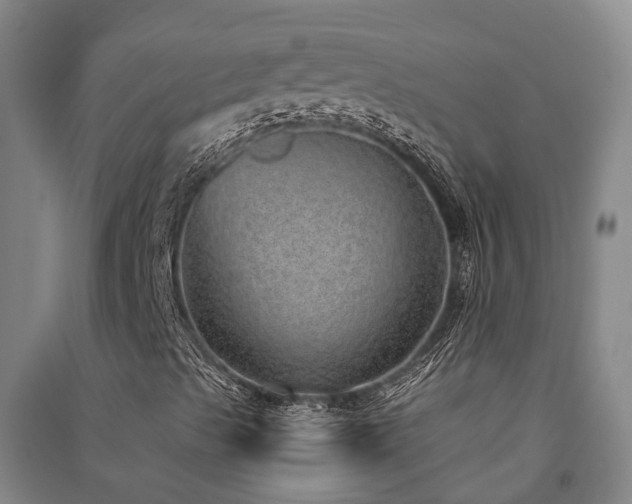 X0000091561489200708171315