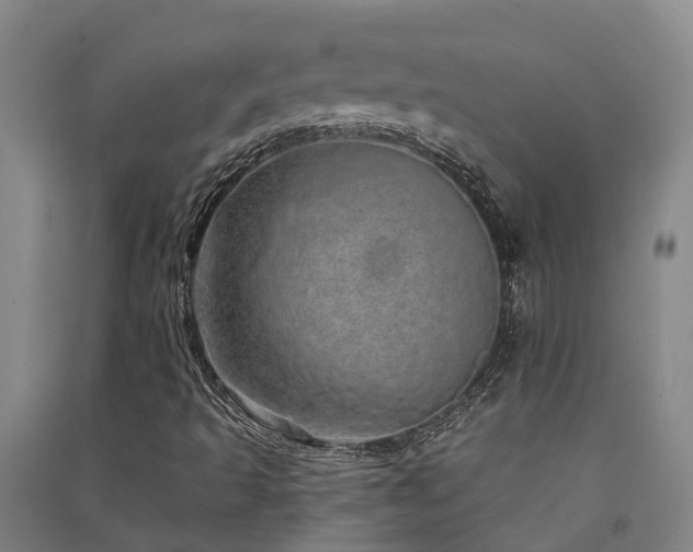 X0000091561493200708171315