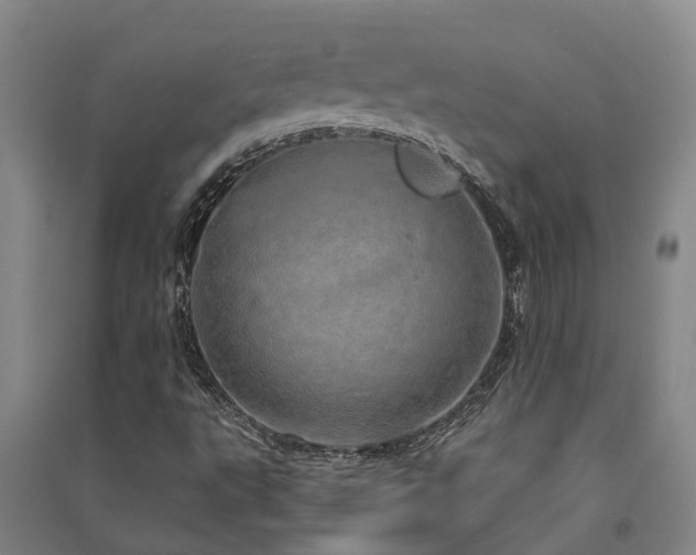 X0000091561495200708171315