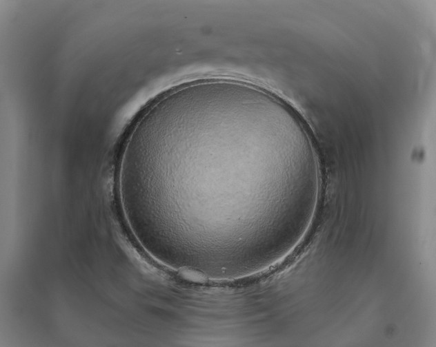 X0000091561503200708171315