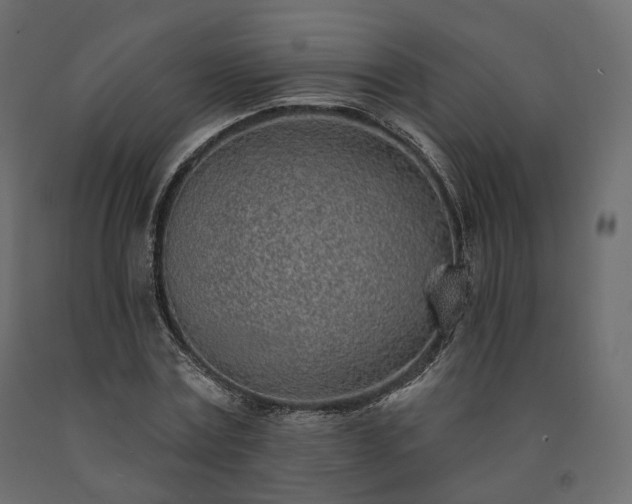 X0000091560779200708241815