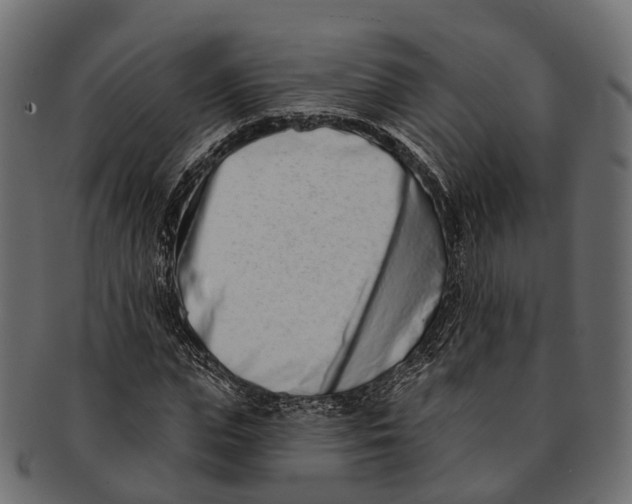 X0000091560823200709071125