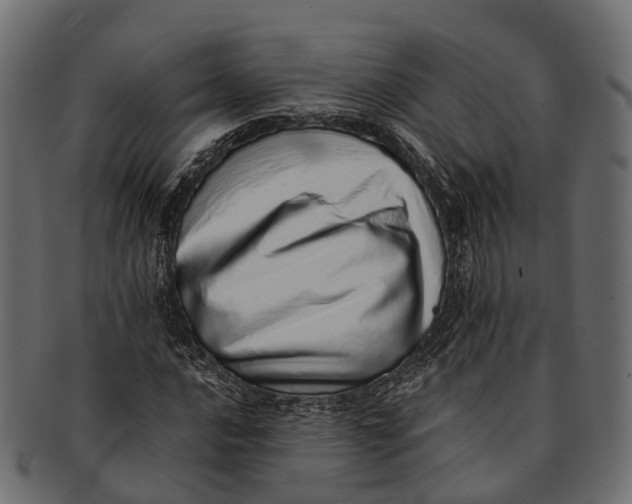 X0000091561016200709071122