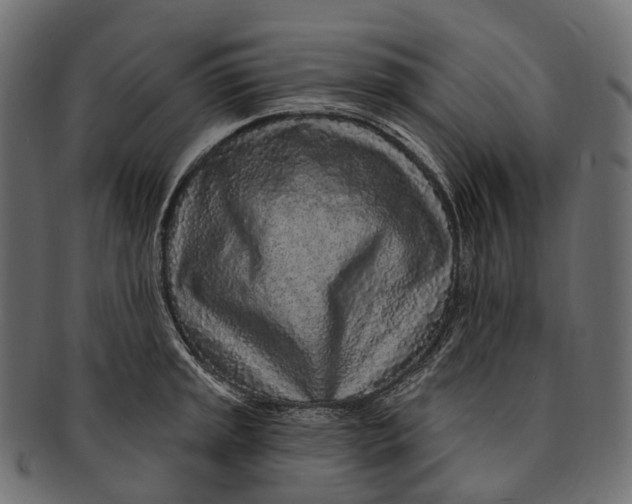 X0000091561045200709071122