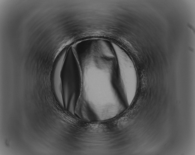 X0000091561218200709071119