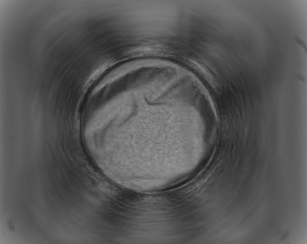 X0000091561419200709071117