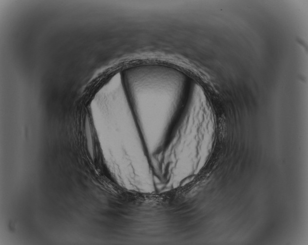 X0000091561494200709071115