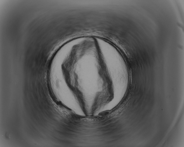 X0000091561500200709071115