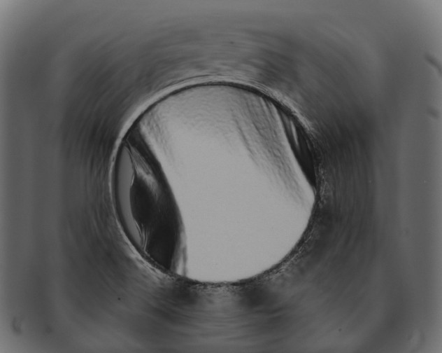 X0000091561516200709071115