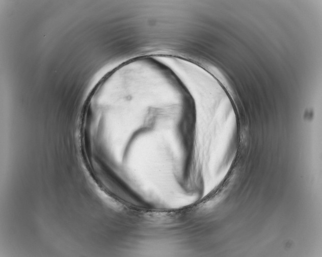 X0000091561149200709141531