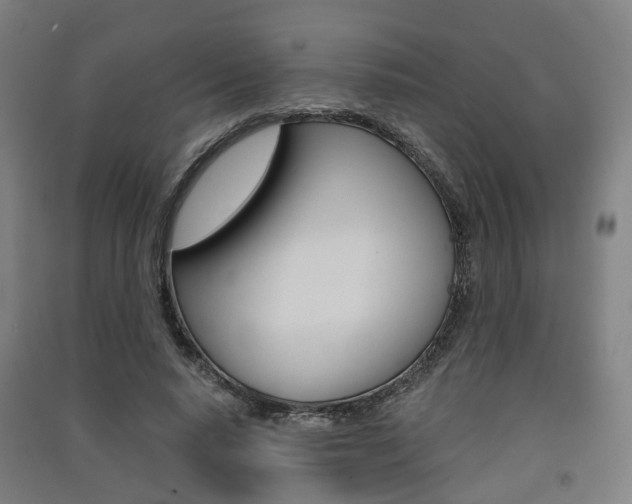 X0000091570640200708200952