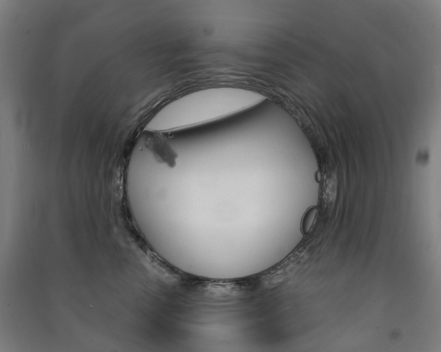 X0000091570666200708200952