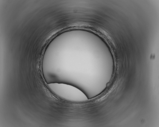 X0000091571017200708200946