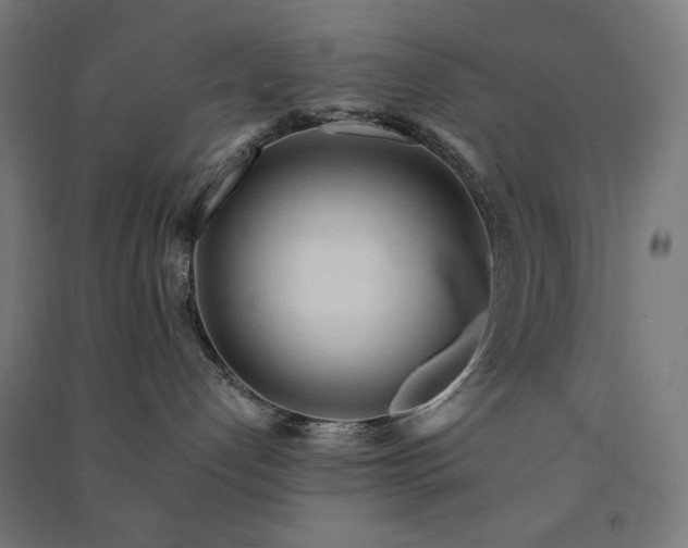 X0000091570192200708201153