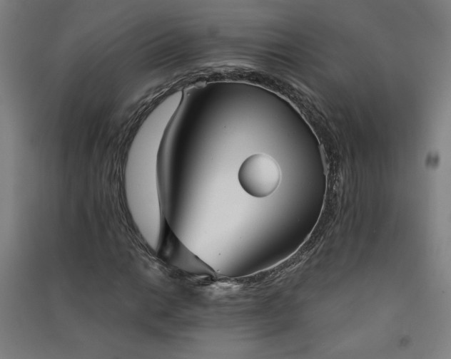 X0000091571014200708201140