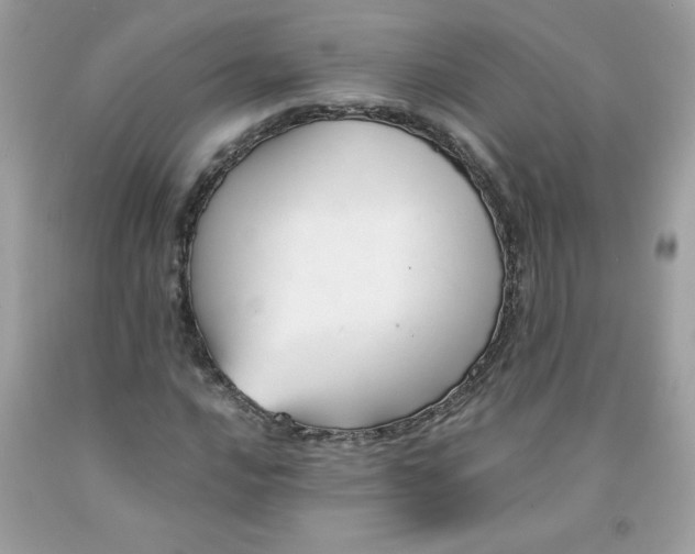 X0000091571016200709051034