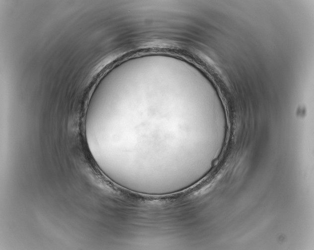 X0000091571017200709100952