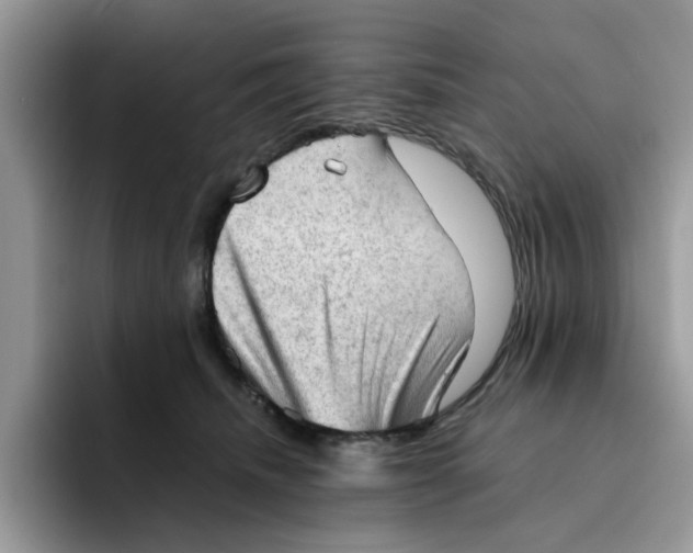 X0000091570468200709171101