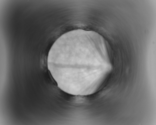 X0000091570528200709171100