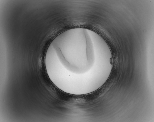 X0000091570644200709171058